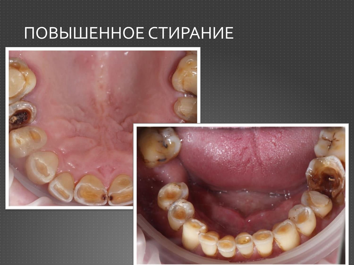 05 03 25 11 1