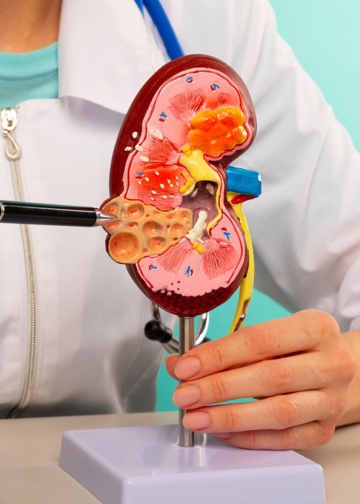 Здоровье почек