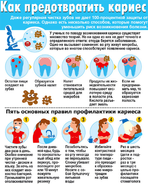 как предотвратить кариес